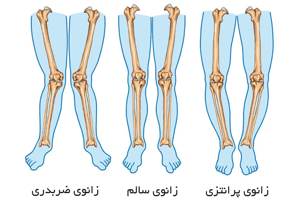 پای پرانتزی