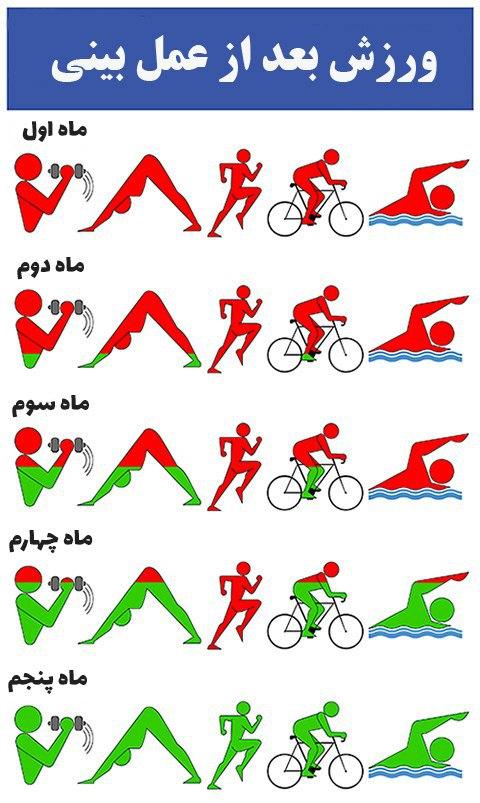 ورزش بعد از عمل بینی